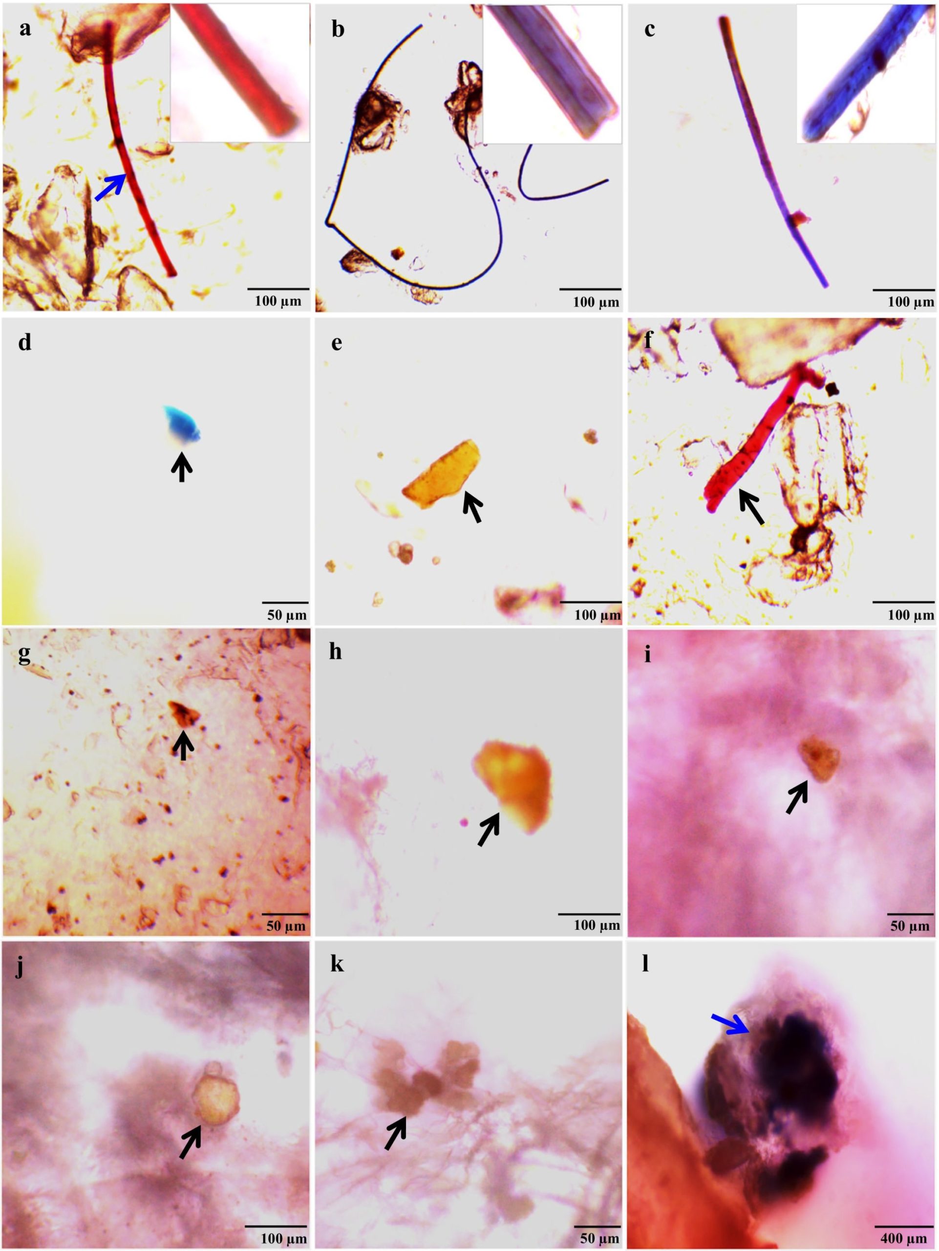 Presence Of Microplastics In Two Common Dried Marine Fish Species From ...